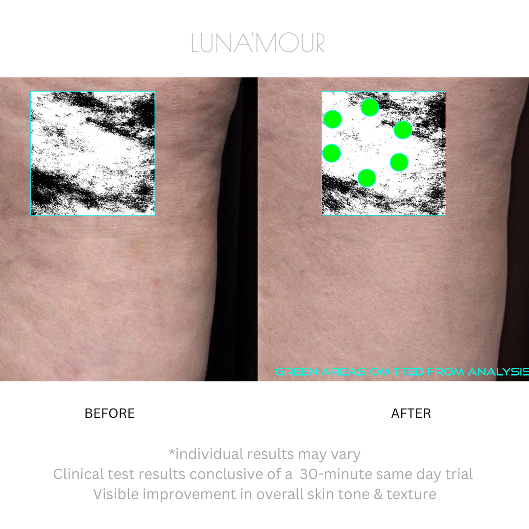 CelluFade BodyBliss, real customer before and after