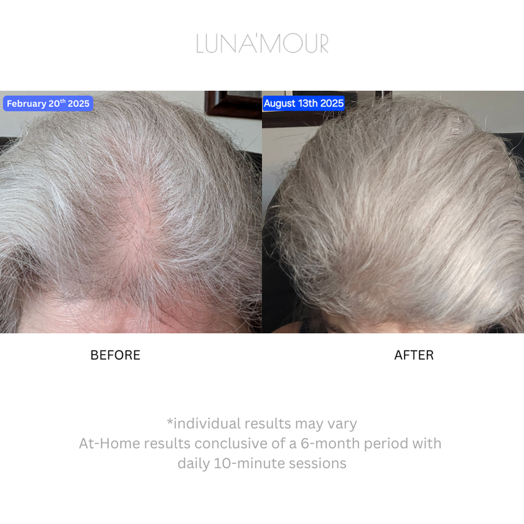 LaserBoost+ RF Sonic & LL-Laser Hair Growth Brush
