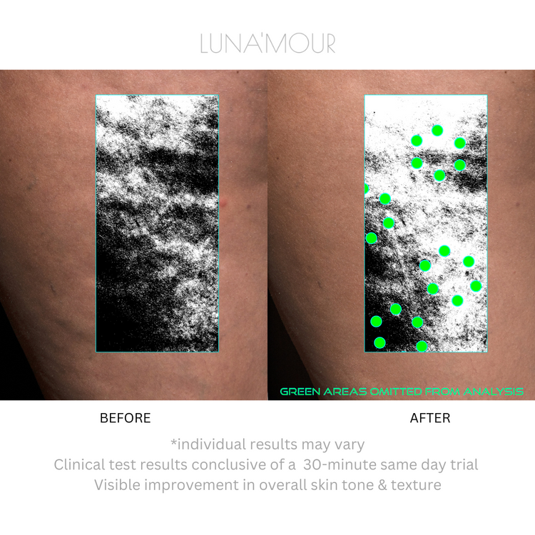 CelluFade BodyBliss: EMS + Vacuum Sculpting + Red Light Therapy Body & Face Device