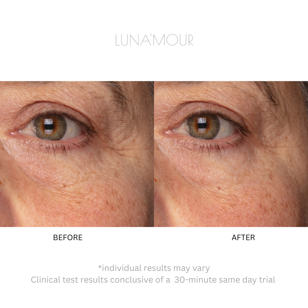 3-in-1 ElectraLume System, real customer before and after