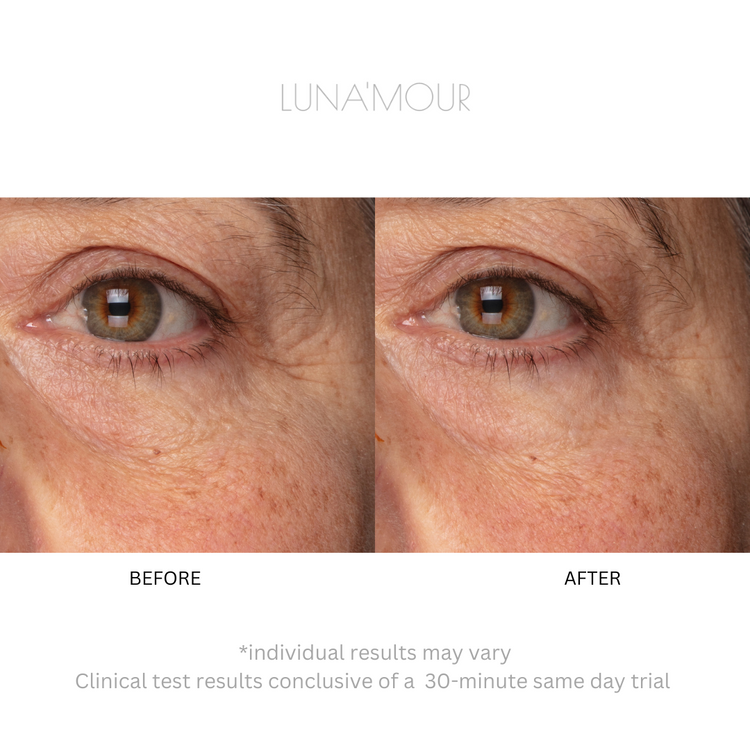 ElectraLume System 3-in-1 Anti-Aging Microcurrent + Light Therapy Device