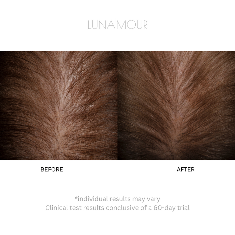 LaserBoost+ RF Sonic & LL-Laser Hair Growth Brush
