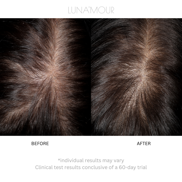 LaserBoost+ RF Sonic & LL-Laser Hair Growth Brush