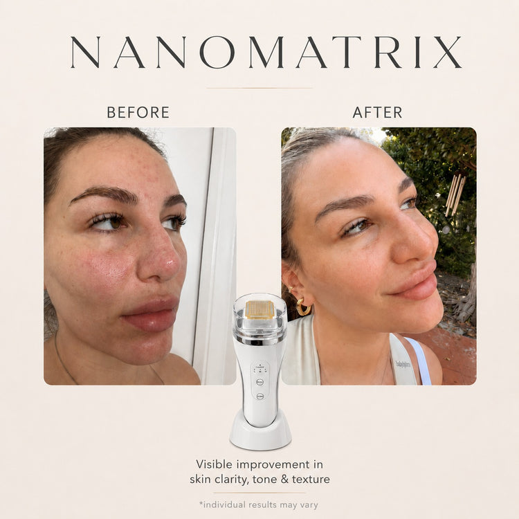 NanoMatrix RF Resurfacing Device Nano MicroNeedling + Fractional Radio Frequency