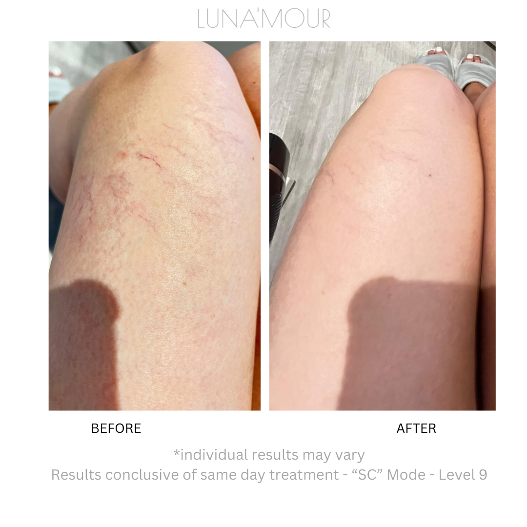 Real customer, before and after