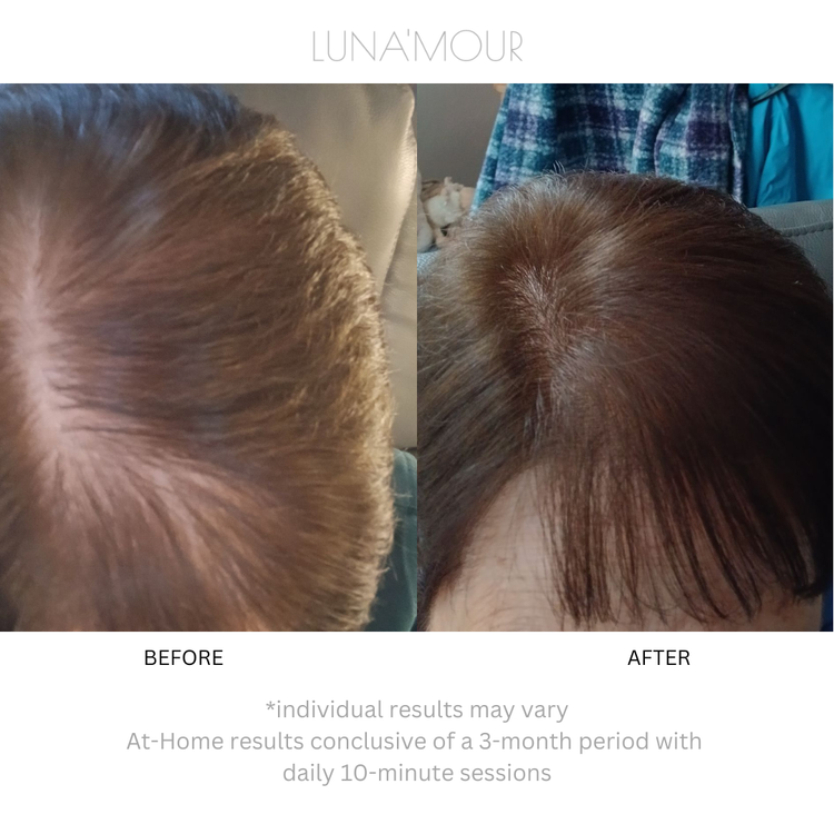 LaserBoost+ RF Sonic & LL-Laser Hair Growth Brush