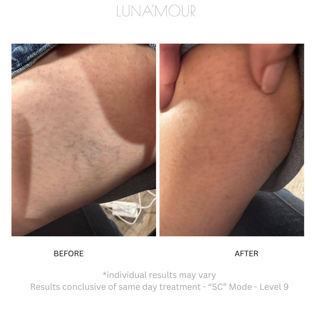 Real customer, before and after
