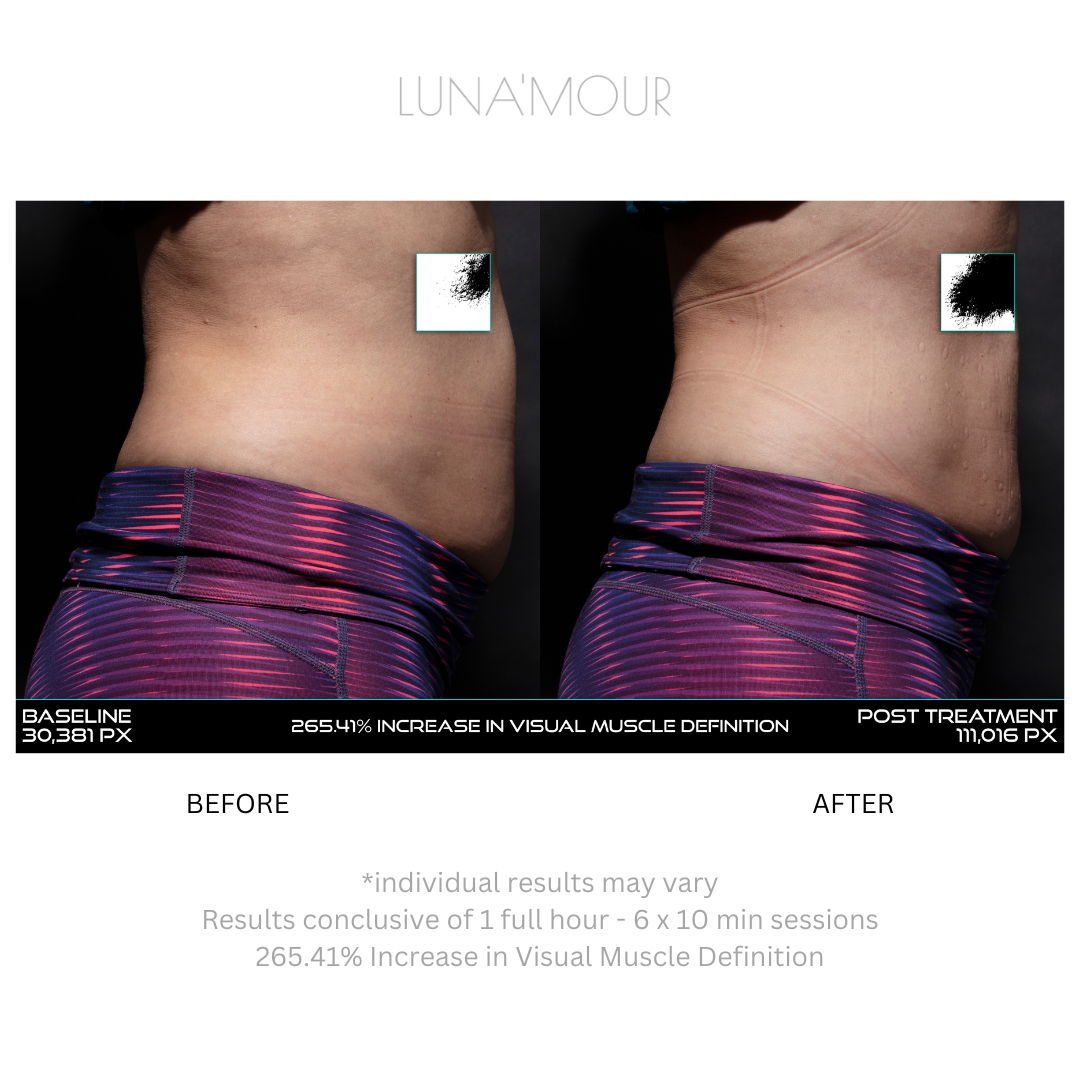 NuFit Pro Belt, real customer before and after