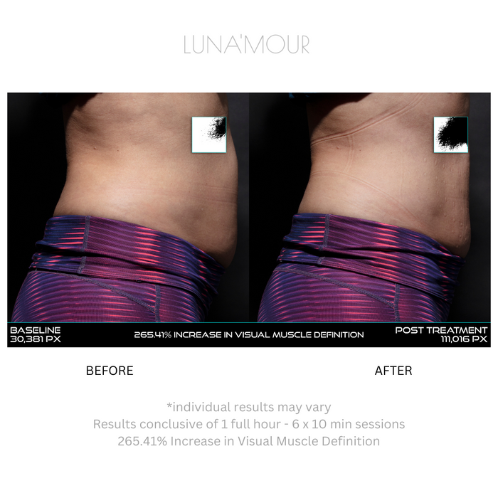 NuFit Pro Belt — before
