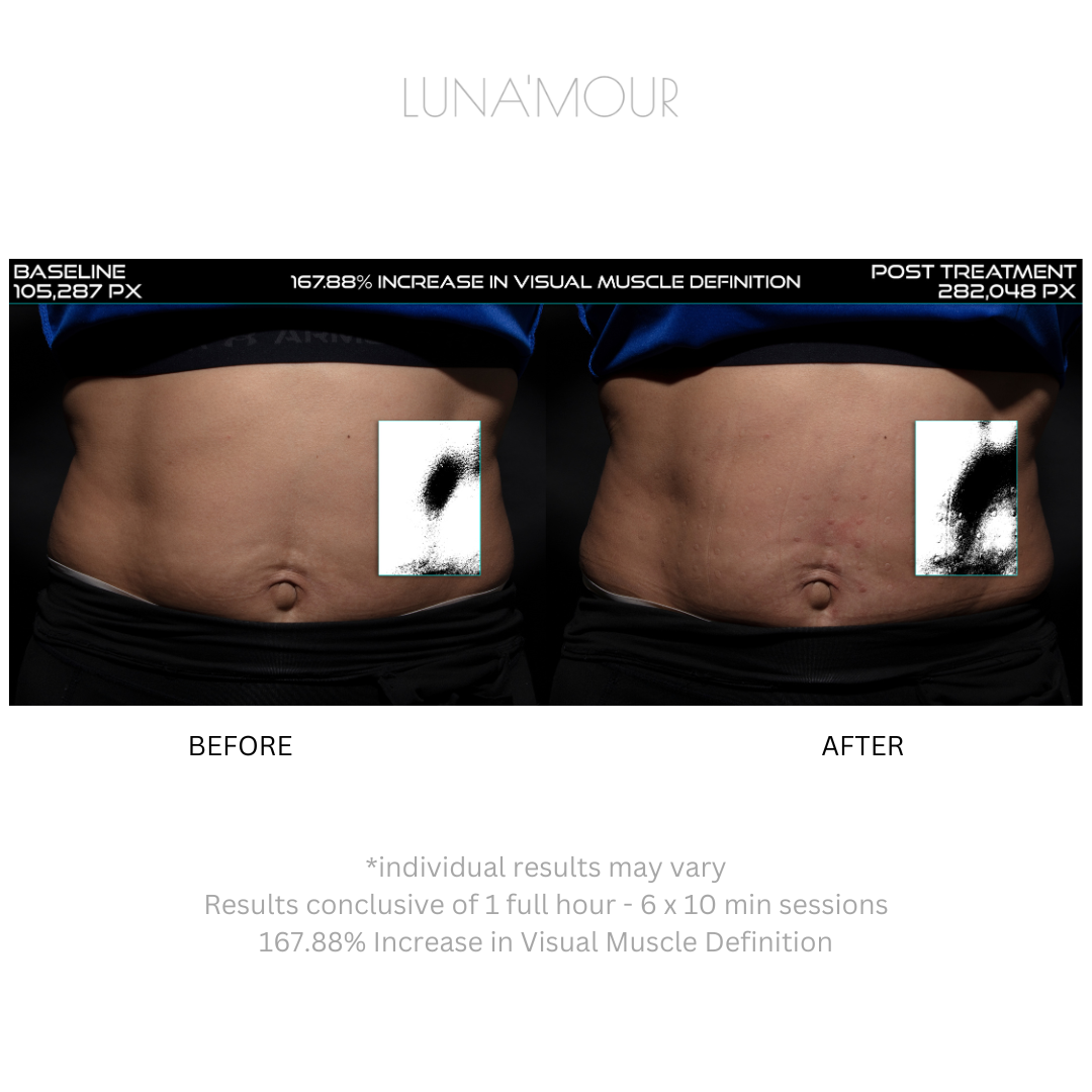NuFit Pro Belt, real customer before and after