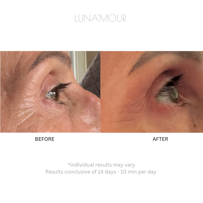 Onyx EyeFix Pro — before