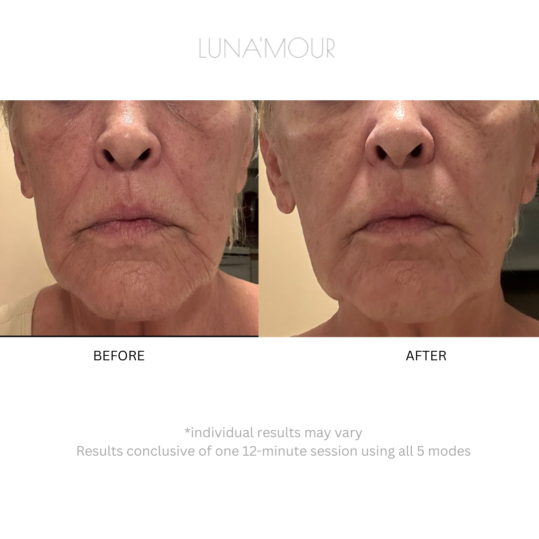 Real customer, featured in the Transformative Results gallery