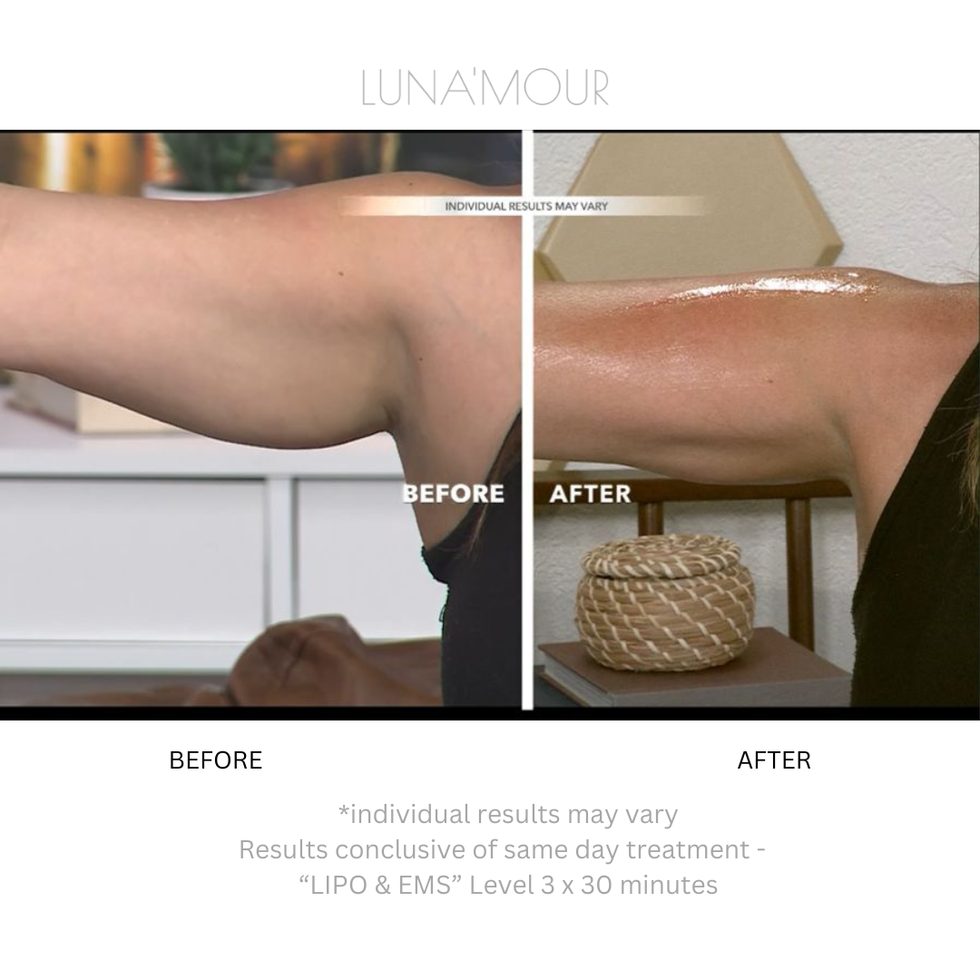 Real customer, before and after