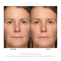 ElectraLume System 3-in-1 Anti-Aging Microcurrent + Light Therapy Device