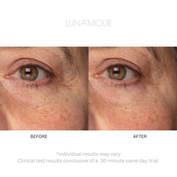 ElectraLume System 3-in-1 Anti-Aging Microcurrent + Light Therapy Device