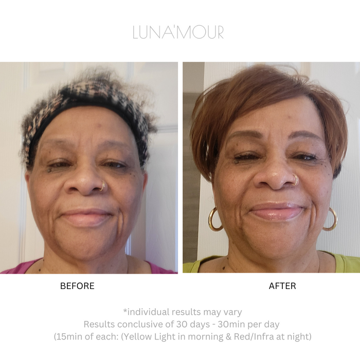AuraLux Advanced+ — before