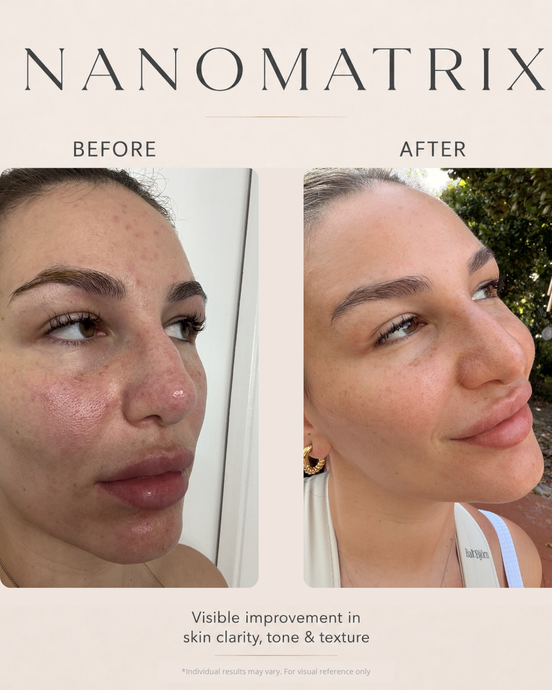 Real customer, before and after