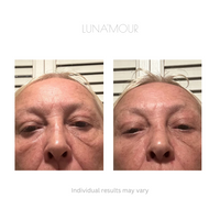 EyeYouth Revival: EMS + Red Light Therapy Device