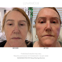 NanoMatrix RF customer before and after, second customer result