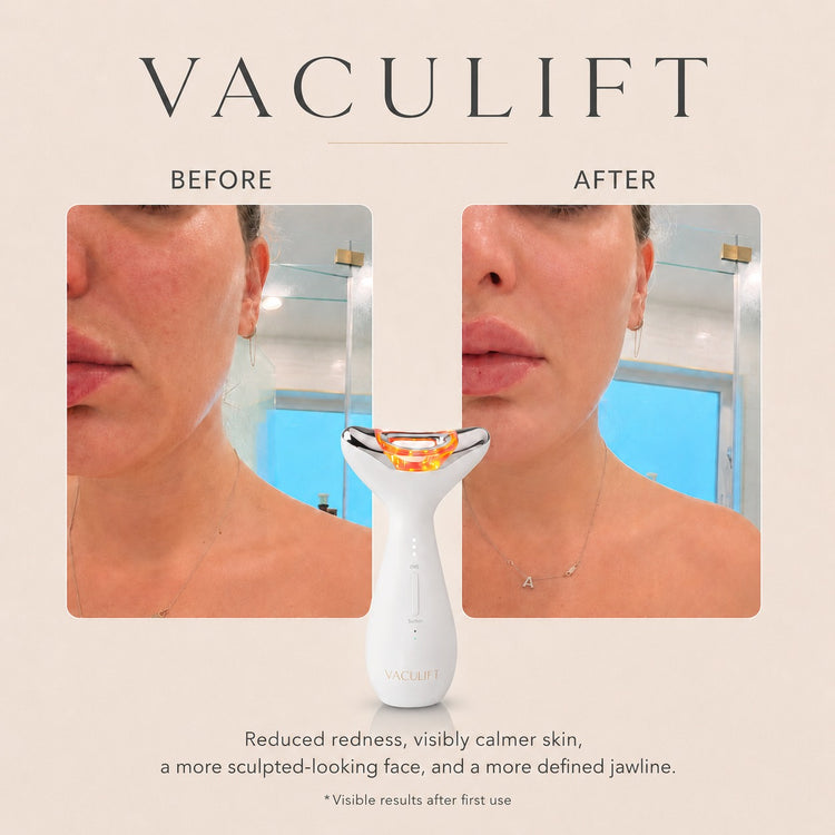 VACULIFT Face & Neck Device Advanced Suction Sculpting System